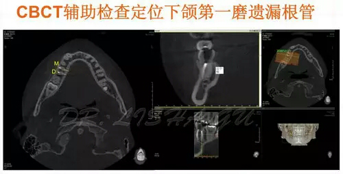 口腔科也拍CT哦~CT检查你知道多少?